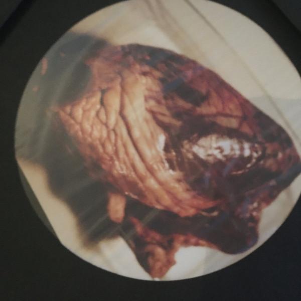 Akatana, Ombossa - Myocarde LP